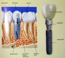 image051.jpg.pagespeed.ce.KhMFChAKBW