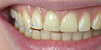 image076.jpg.pagespeed.ce.uji18MnIh2